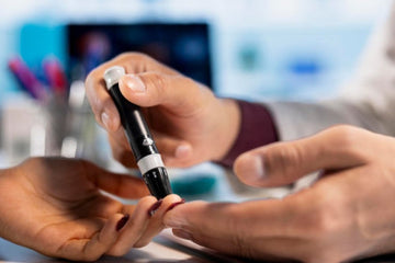 Dexcom G7 vs Other Glucose Monitoring Options: What to Know