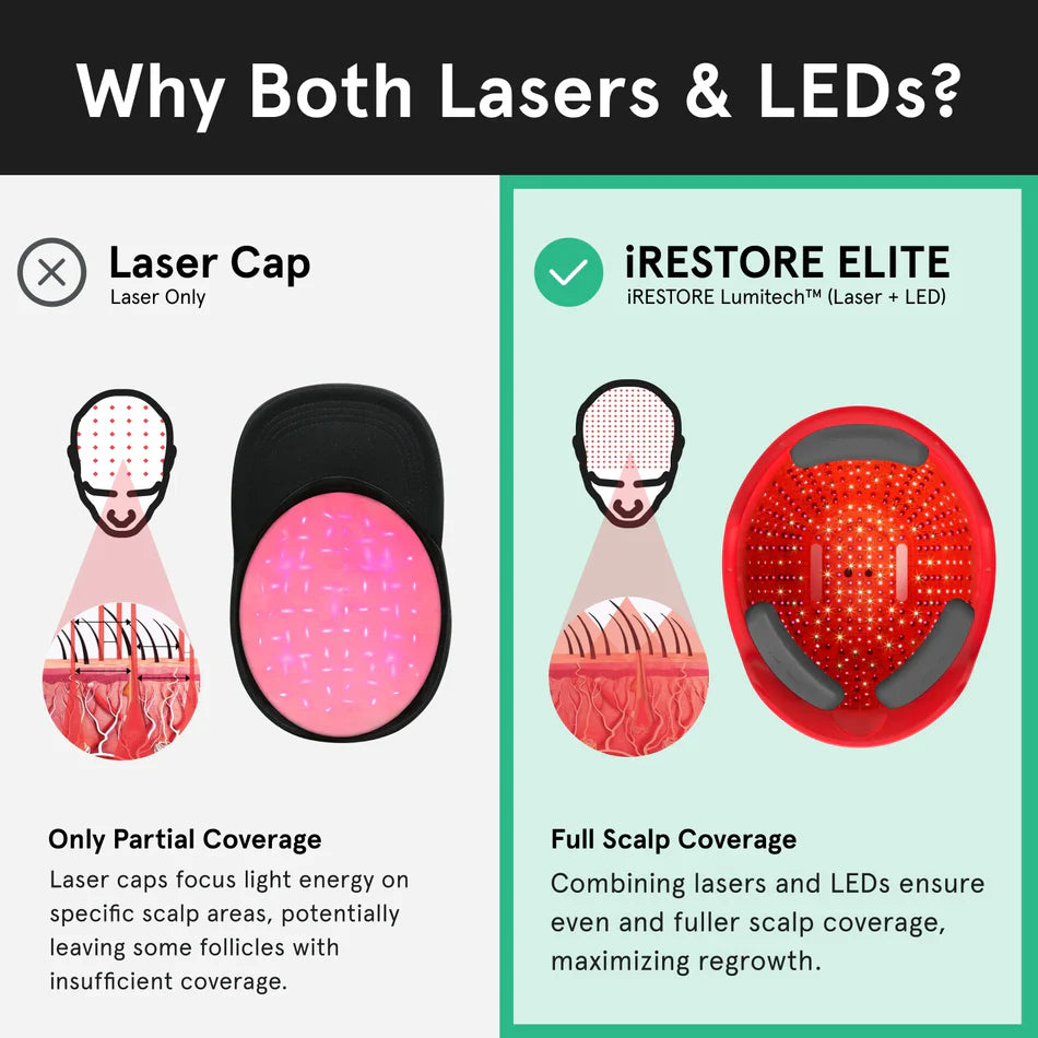 iRESTORE Elite Laser Hair Growth System - HSA/FSA Eligible