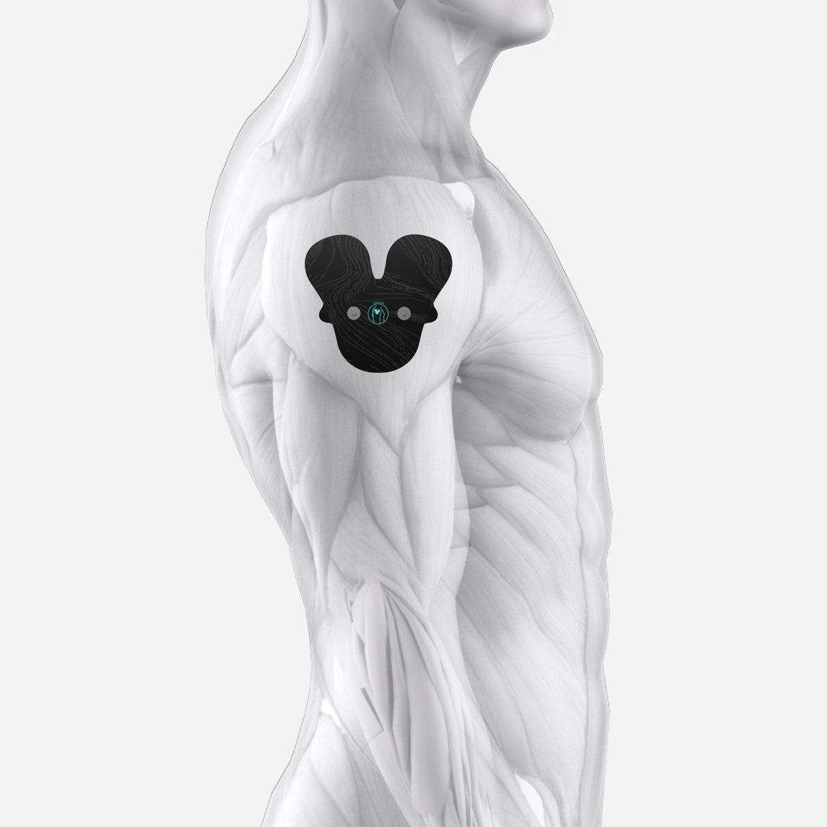 Chirp Halo EMS muscle stimulator for arm pain relief and recovery