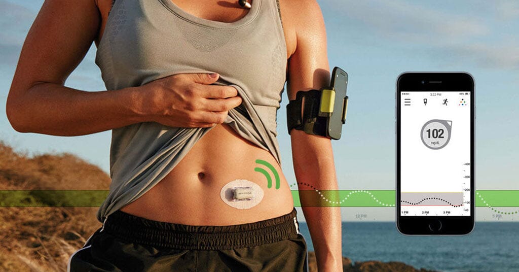 Dexcom image