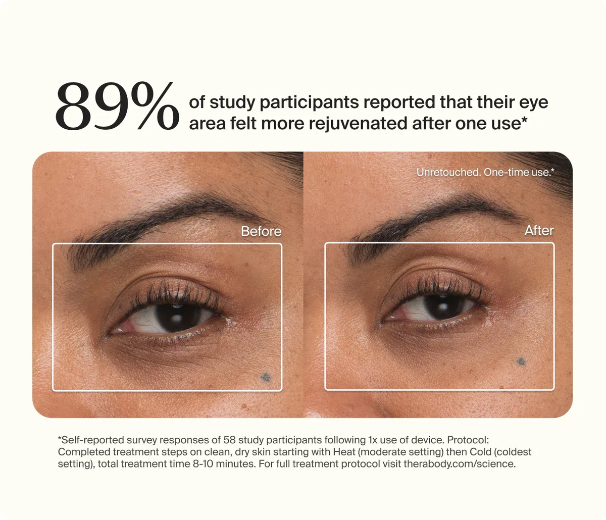 Before and after results demonstrating improved under-eye appearance with TheraFace Depuff treatments