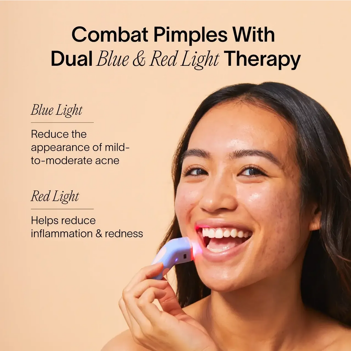 Solawave Bye Acne: 3-Minute Pimple Spot Treatment
